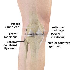 Multi-Ligament Knee Injuries Chicago, IL